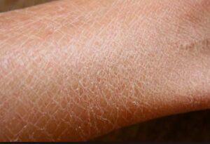 4-10 сентября 2023 г. — неделя, посвященная профилактике кожных заболеваний